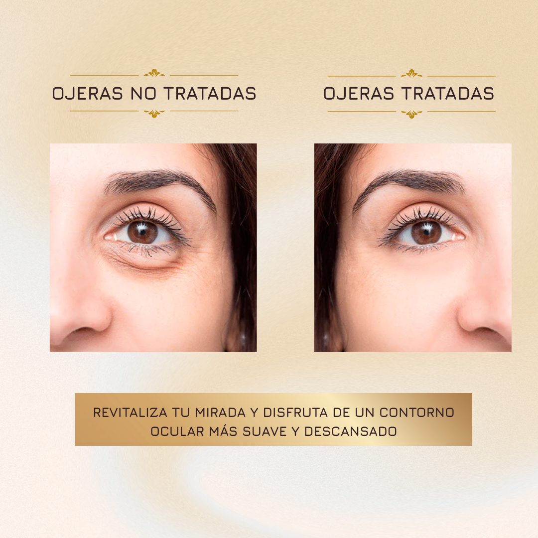 Roll-On Tuz ™️ | Ayuda a disminuir la apariencia de ojeras y refrescar tu mirada