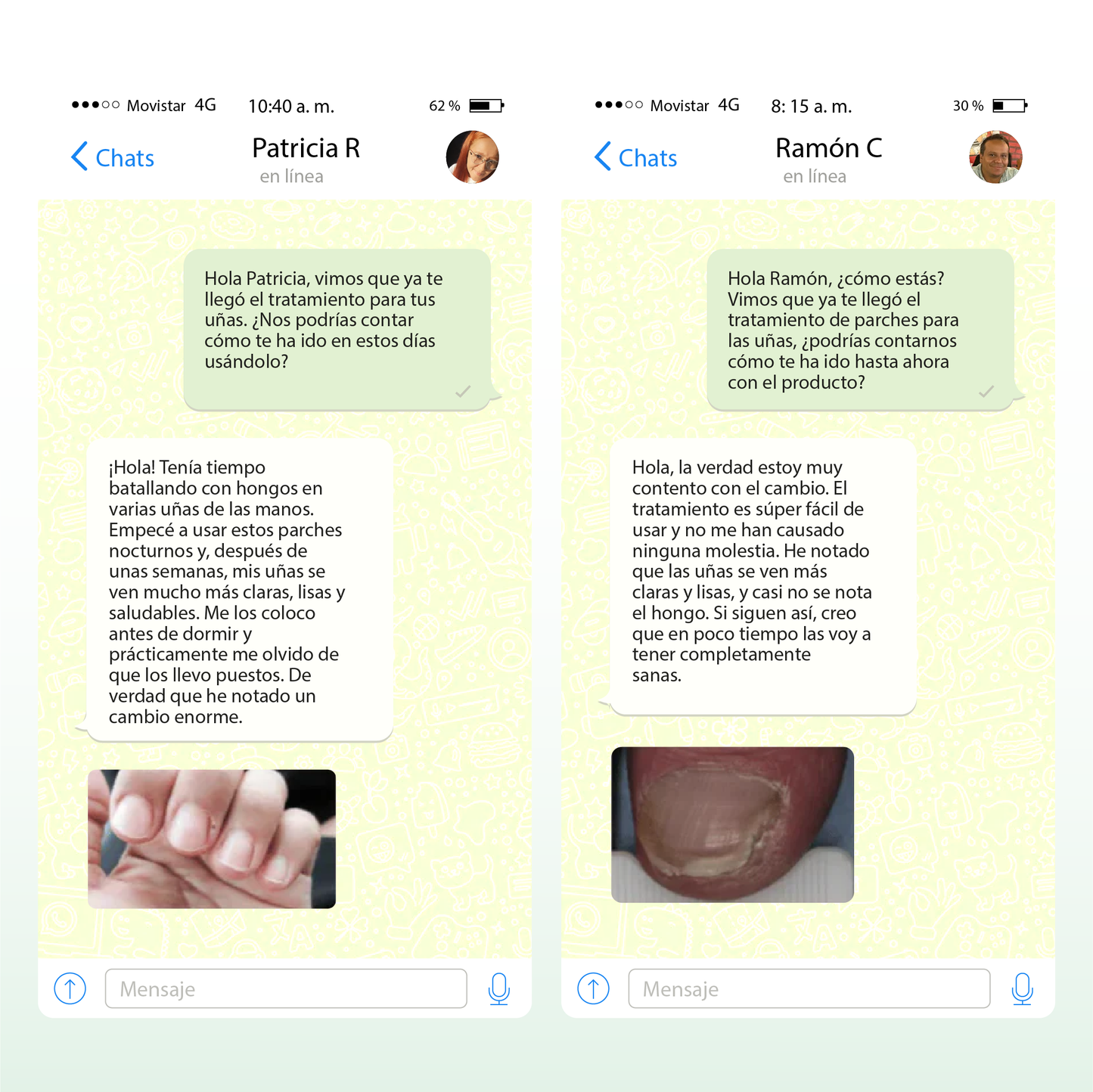 Parches AntiHongos | Uñas renovadas y sanas