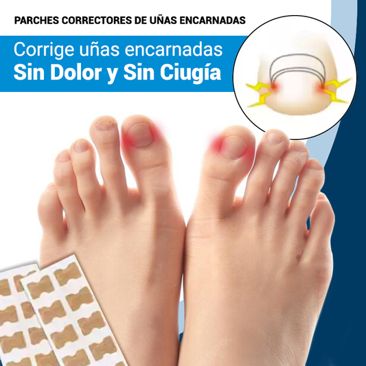Corrige uñas encarnadas sin dolor y sin cirugía