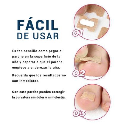 Corrige uñas encarnadas sin dolor y sin cirugía