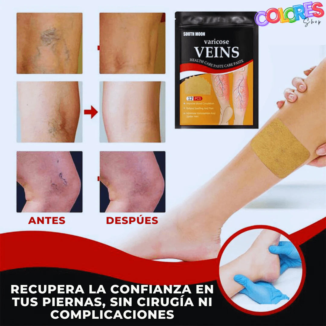 Parche para varices 12 unidades