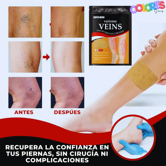Parche para varices 12 unidades