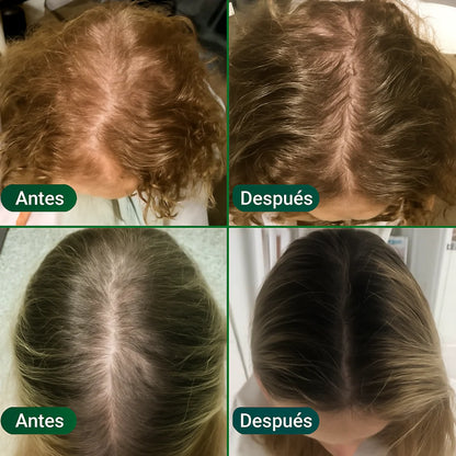 Aceite capilar | Activa el crecimiento desde la raíz