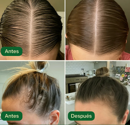 Aceite capilar | Activa el crecimiento desde la raíz