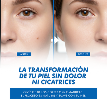 Parches Removedores de Verrugas – Pack 144 Unidades