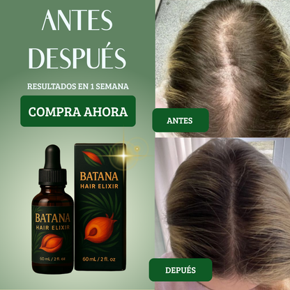 Batana Hair Elixir™️ | Revitaliza tu Cuero Cabelludo y Estimula el Crecimiento Natural