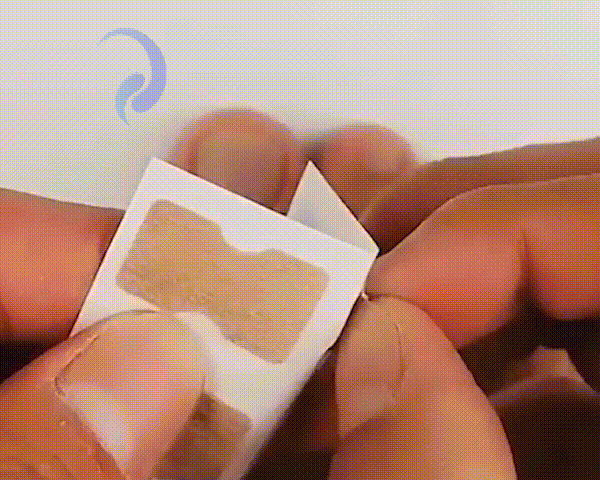 Corrige uñas encarnadas sin dolor y sin cirugía