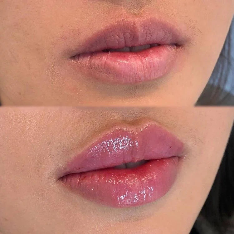 BeautyLip™️ | Realza tus Labios y Luce Radiante