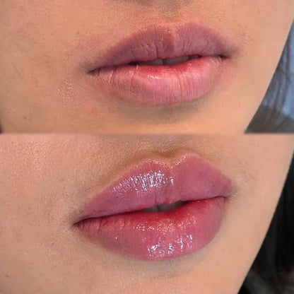 BeautyLip™️ | Realza tus Labios y Luce Radiante